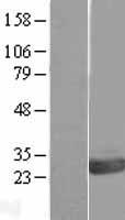OVCA2 Human Over-expression Lysate