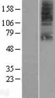 SLC22A9 Human Over-expression Lysate