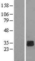 Deoxyguanosine kinase (DGUOK) Human Over-expression Lysate