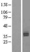 Asialoglycoprotein Receptor 2 (ASGR2) Human Over-expression Lysate
