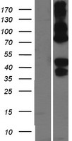 Asialoglycoprotein Receptor 2 (ASGR2) Human Over-expression Lysate
