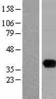 UNG Human Over-expression Lysate