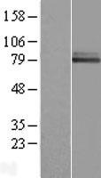 WHIP (WRNIP1) Human Over-expression Lysate