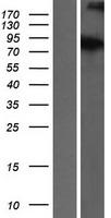 ATRIP Human Over-expression Lysate