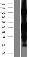 ZC3HAV1L Human Over-expression Lysate