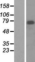 Menin (MEN1) Human Over-expression Lysate