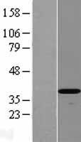 DEDD2 Human Over-expression Lysate