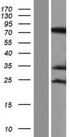 RAVER1 Human Over-expression Lysate
