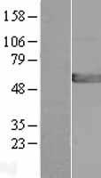 GPT2 Human Over-expression Lysate