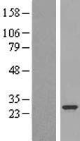 Plunc (BPIFA1) Human Over-expression Lysate