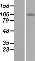Smoothelin (SMTN) Human Over-expression Lysate