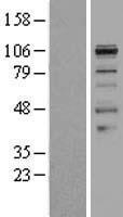 Smoothelin (SMTN) Human Over-expression Lysate