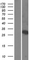 WSB1 Human Over-expression Lysate