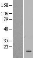 CSTL1 Human Over-expression Lysate