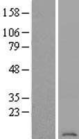 ATP6V1G2 Human Over-expression Lysate