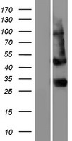 PTCRA Human Over-expression Lysate