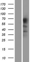 PACE4 (PCSK6) Human Over-expression Lysate