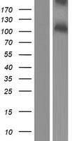 PACE4 (PCSK6) Human Over-expression Lysate