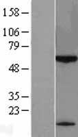 KLHDC7B Human Over-expression Lysate