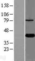 KTI12 Human Over-expression Lysate