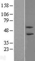 PHF21B Human Over-expression Lysate