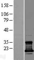 CMTM7 Human Over-expression Lysate