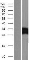 MYLC2PL (MYL10) Human Over-expression Lysate