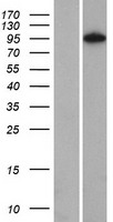 NOM1 Human Over-expression Lysate