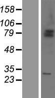SHKBP1 Human Over-expression Lysate