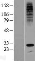 G6PC3 Human Over-expression Lysate