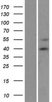 MCU Human Over-expression Lysate