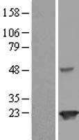 Josephin 2 (JOSD2) Human Over-expression Lysate