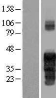 PABIR1 Human Over-expression Lysate