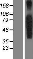 FOXP4 Human Over-expression Lysate