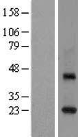 RAB3C Human Over-expression Lysate