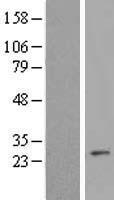 C7orf30 (MALSU1) Human Over-expression Lysate