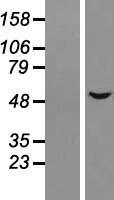 ALS2CR15 (ICA1L) Human Over-expression Lysate