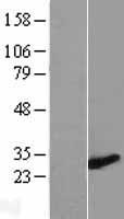ZMYND19 Human Over-expression Lysate