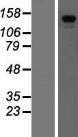 CDAN1 Human Over-expression Lysate
