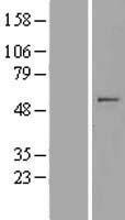 MIPOL 1 (MIPOL1) Human Over-expression Lysate