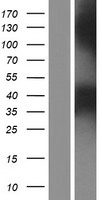 PPT2 Human Over-expression Lysate