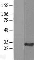 IFTAP Human Over-expression Lysate