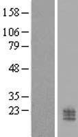CCDC126 Human Over-expression Lysate