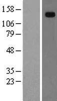 Hephaestin (HEPH) Human Over-expression Lysate