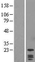 DYDC1 Human Over-expression Lysate