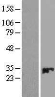 CMBL Human Over-expression Lysate
