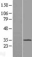 C3ORF31 (TAMM41) Human Over-expression Lysate