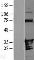ANKRD54 Human Over-expression Lysate