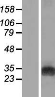 GAMT Human Over-expression Lysate
