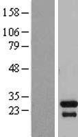 TGIF2LX Human Over-expression Lysate